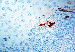 антитела к ВПГ-2