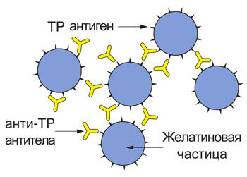 тест TPPA сифилис