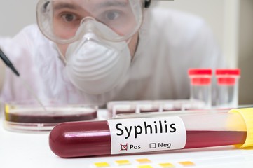 Сифилис