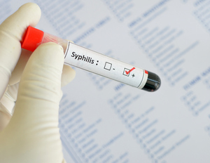 syphilis_positive.jpg