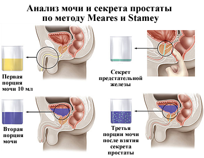prostata analize)