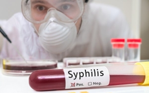 Экспресс диагностика сифилиса